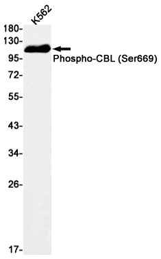 Phospho-CBL (Ser669) Rabbit mAb ABZ4529