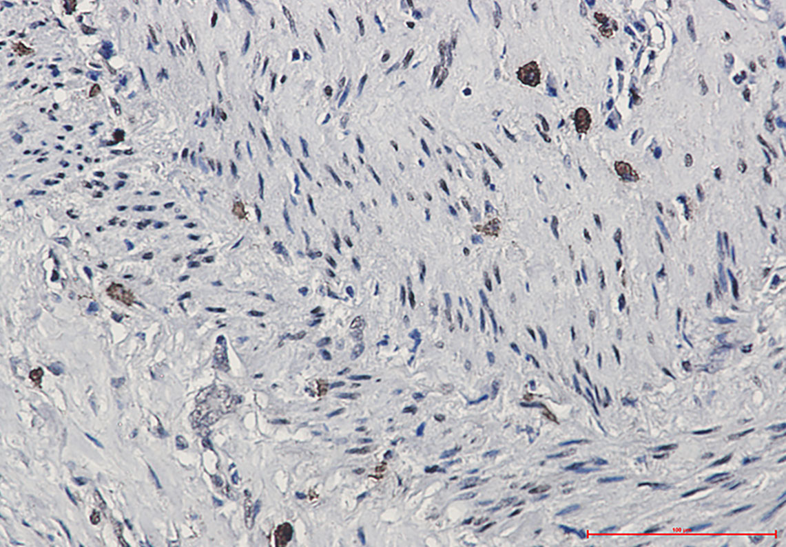 Phospho-CREB (Ser133) Rabbit mAb ABZ4533