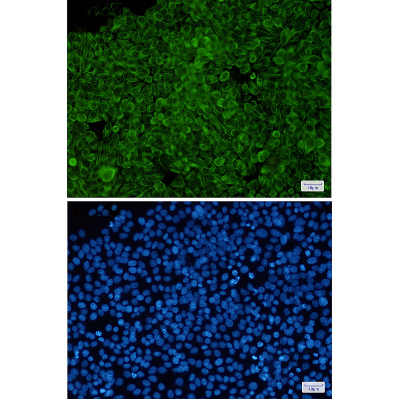 Phospho-Cytokeratin 8 (Ser23) Rabbit mAb ABZ4534