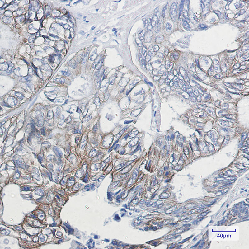 Phospho-Cytokeratin 8 (Ser23) Rabbit mAb ABZ4534