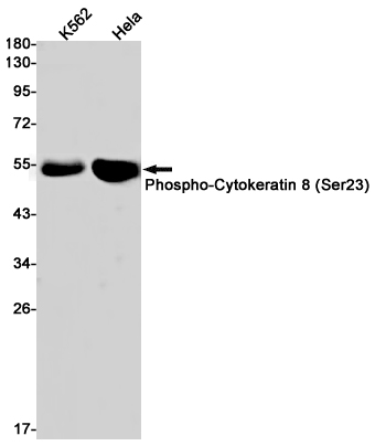 Phospho-Cytokeratin 8 (Ser23) Rabbit mAb ABZ4534