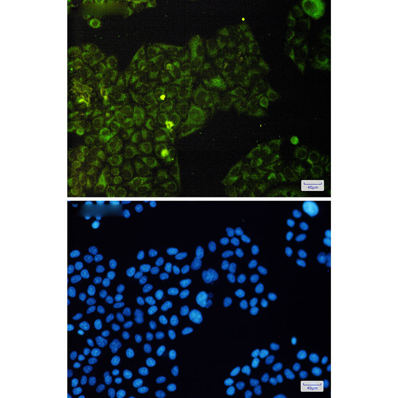 Phospho-eIF4E (Ser209) Rabbit mAb ABZ4536