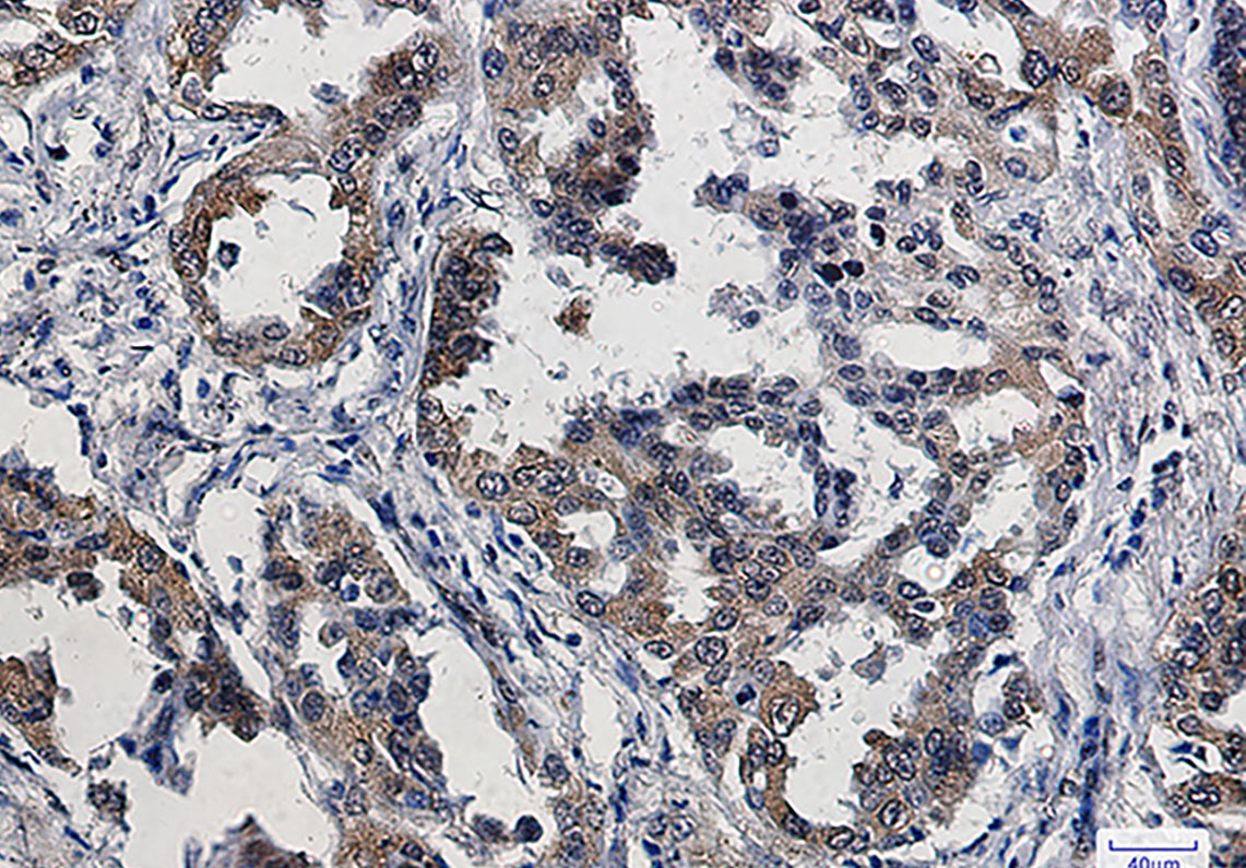 Phospho-eIF4E (Ser209) Rabbit mAb ABZ4536