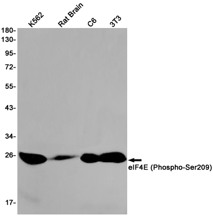 Phospho-eIF4E (Ser209) Rabbit mAb ABZ4536