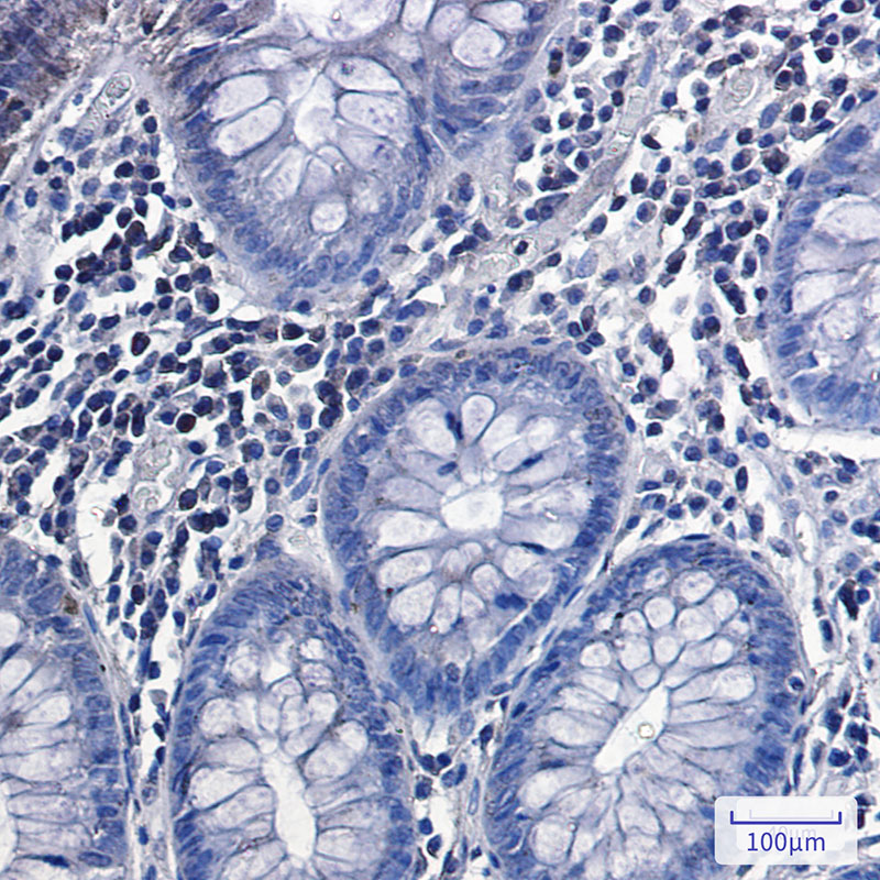 Phospho-Glycogen synthase 1/GYS1(Ser641) Rabbit mAb ABZ4537