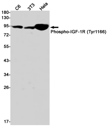 Phospho-IGF1 Receptor (Tyr1166) Rabbit mAb ABZ4538