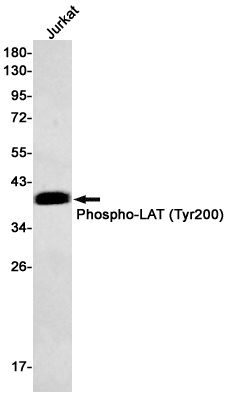Phospho-LAT (Tyr200) Rabbit mAb ABZ4539