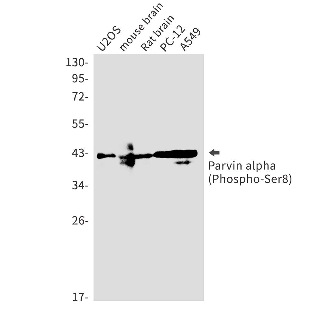 Phospho-Parvin alpha (Ser8) Rabbit mAb ABZ4541