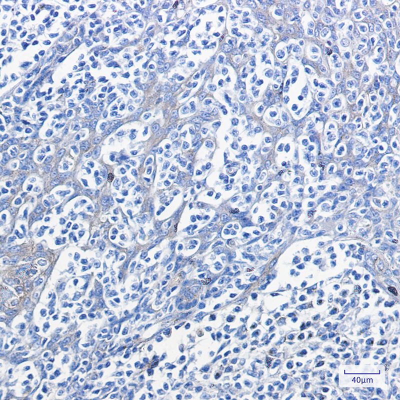 Phospho-PRKAR2A (Ser99) Rabbit mAb ABZ4542