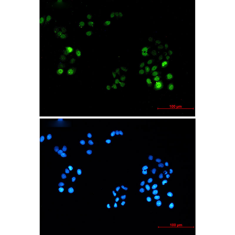 Phospho-PRC1 (Thr481) Rabbit mAb ABZ4543