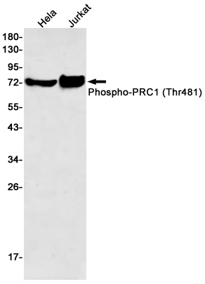 Phospho-PRC1 (Thr481) Rabbit mAb ABZ4543