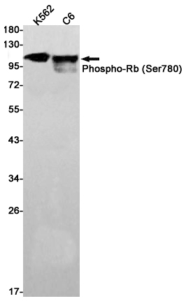 Phospho-Rb (Ser780) Rabbit mAb ABZ4545