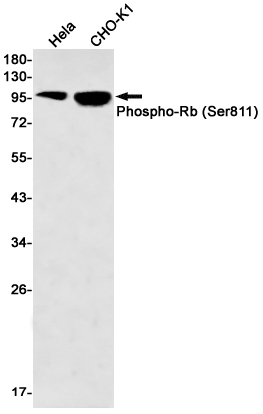 Phospho-Rb (Ser811) Rabbit mAb ABZ4546