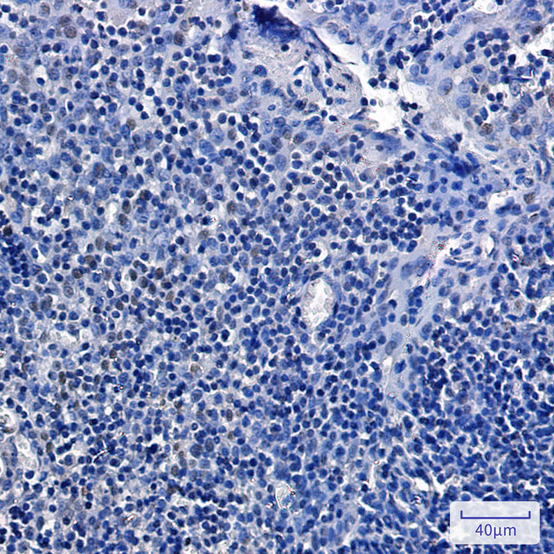 Phospho-Rb2 p130 (Ser952) Rabbit mAb ABZ4547