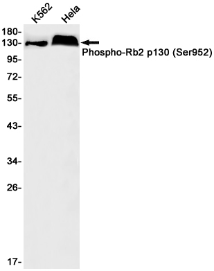 Phospho-Rb2 p130 (Ser952) Rabbit mAb ABZ4547