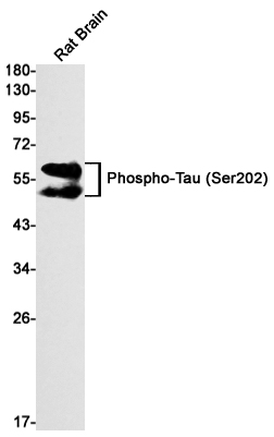 Phospho-Tau (Ser202) Rabbit mAb ABZ4548