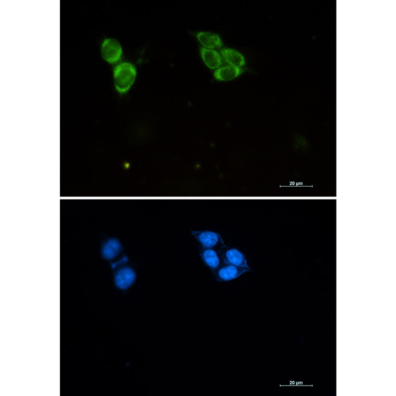 Phospho-Tau (Thr50) Rabbit mAb ABZ4550
