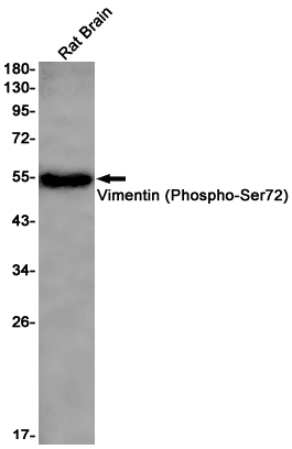 Phospho-Vimentin (Ser72) Rabbit mAb ABZ4551