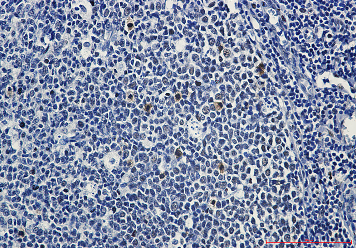 Phospho-c Myb (Ser11) Rabbit mAb ABZ4552