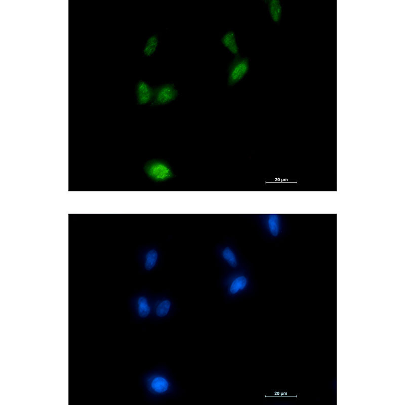 Phospho-Amyloid Precursor Protein (Thr743)  Rabbit mAb ABZ4553