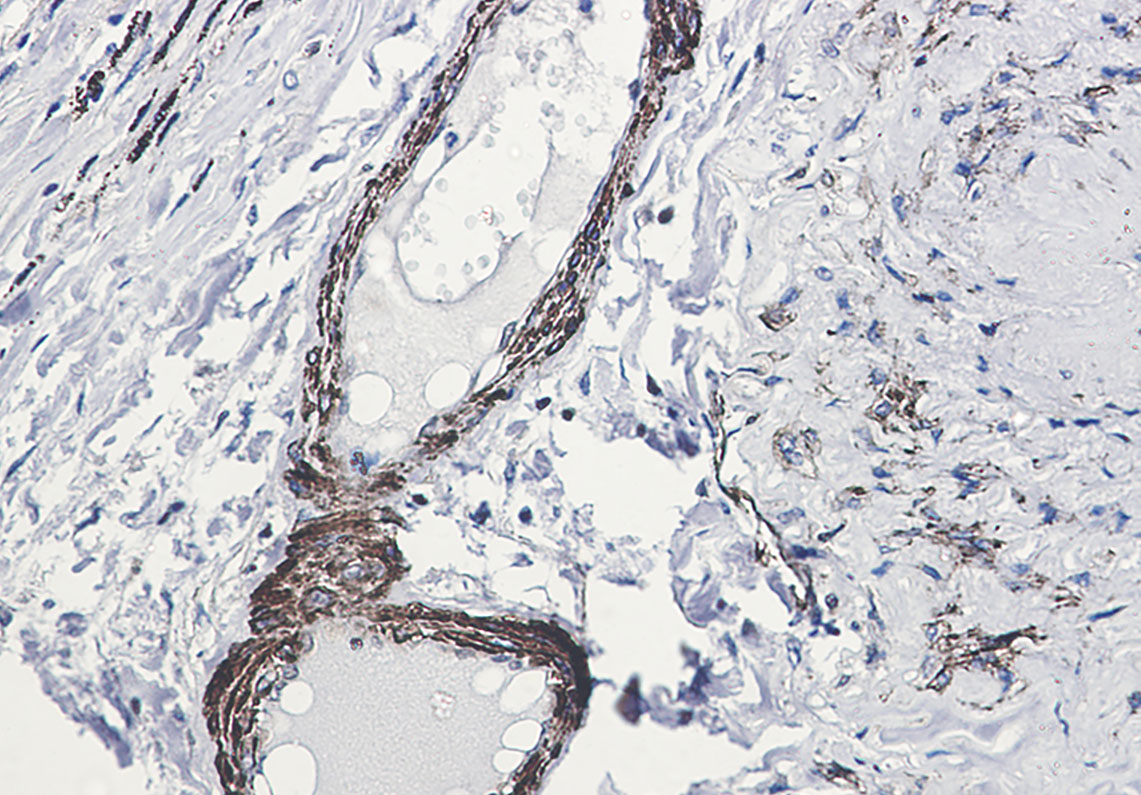 Phospho-beta Arrestin 1 (Ser412) Rabbit mAb ABZ4554