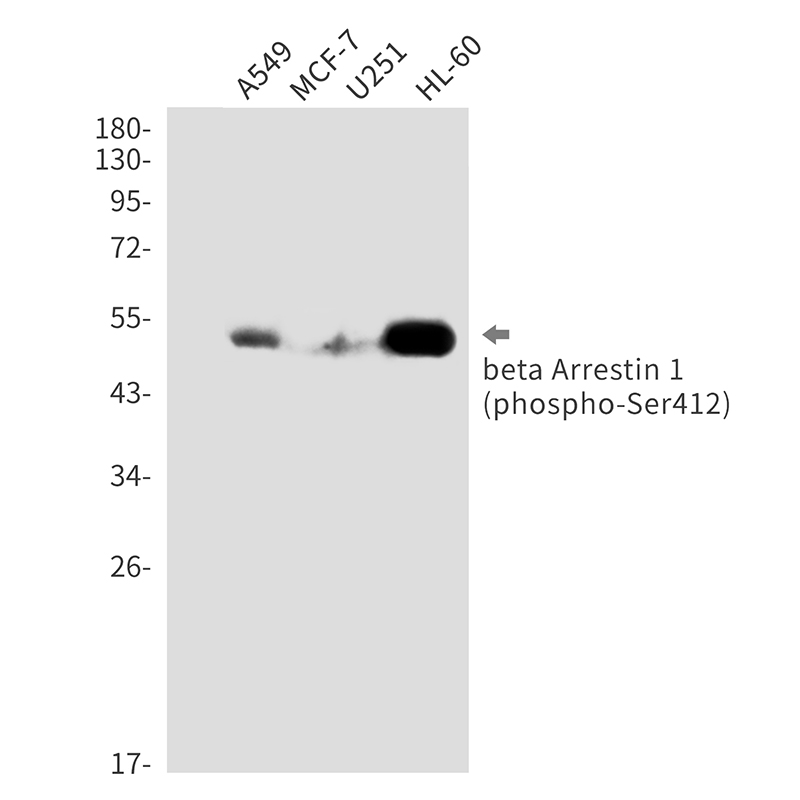 Phospho-beta Arrestin 1 (Ser412) Rabbit mAb ABZ4554