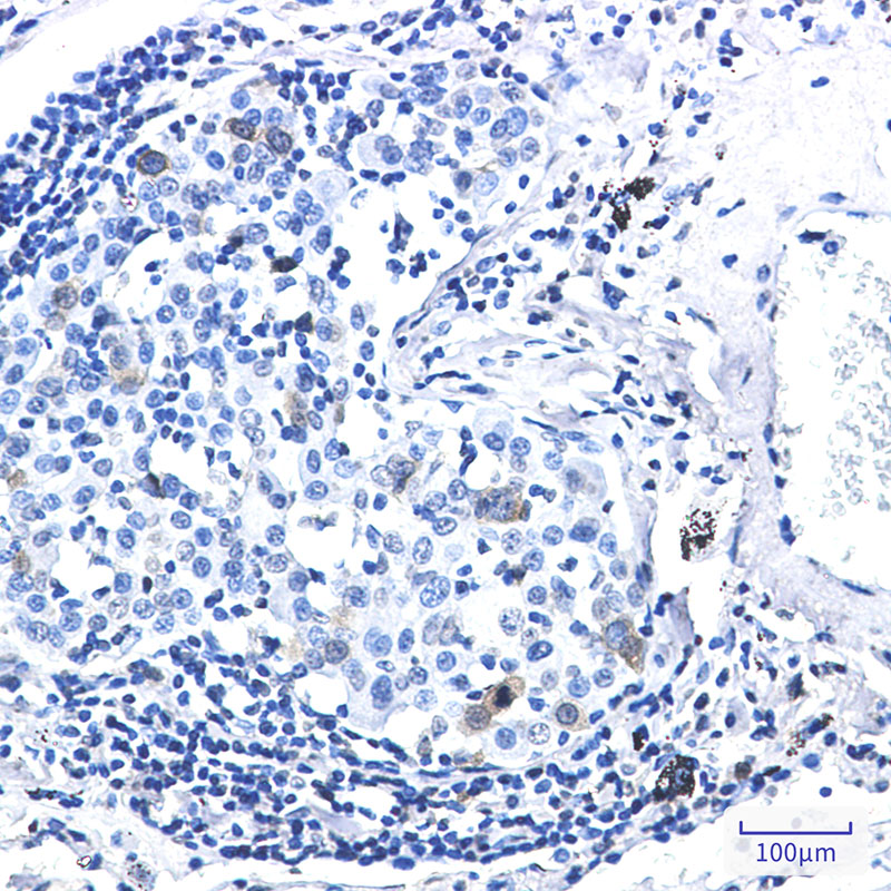 Phospho-CDK1/2 (Thr14) Rabbit mAb ABZ4555
