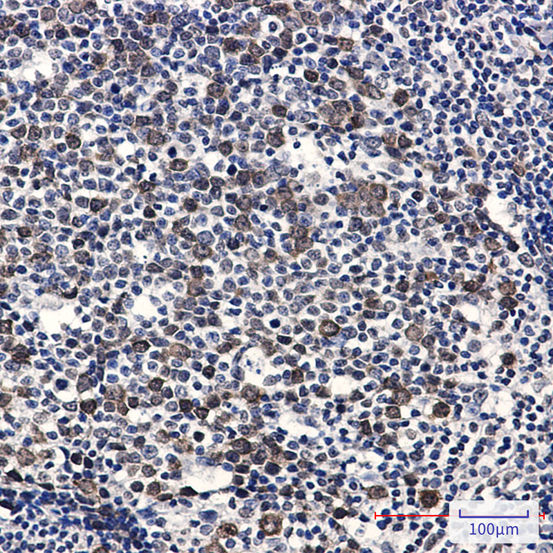 Phospho-CDK2 (Thr14) Rabbit mAb ABZ4556