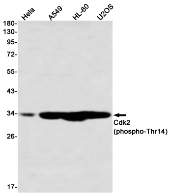 Phospho-CDK2 (Thr14) Rabbit mAb ABZ4556
