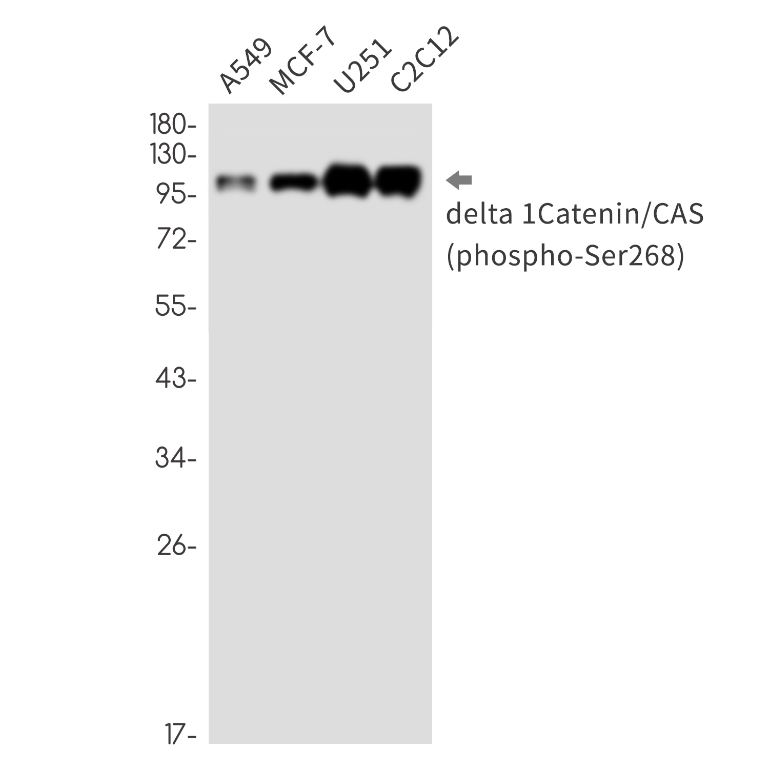 Phospho-delta 1 Catenin (Ser268) Rabbit mAb ABZ4557