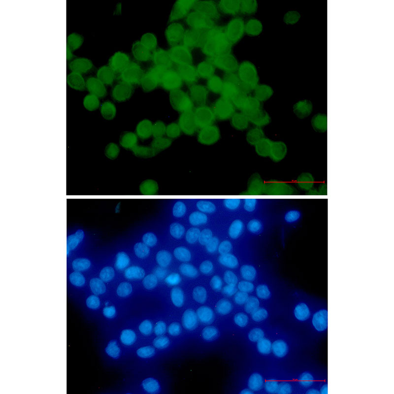Phospho-delta 1 Catenin (Thr916) Rabbit mAb ABZ4558