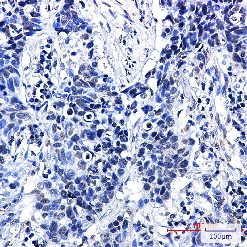 Phospho-delta 1 Catenin (Thr916) Rabbit mAb ABZ4558