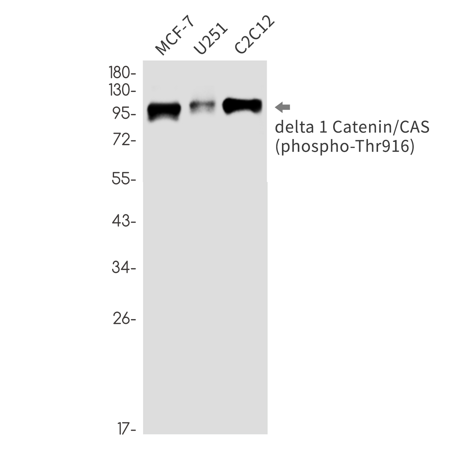 Phospho-delta 1 Catenin (Thr916) Rabbit mAb ABZ4558