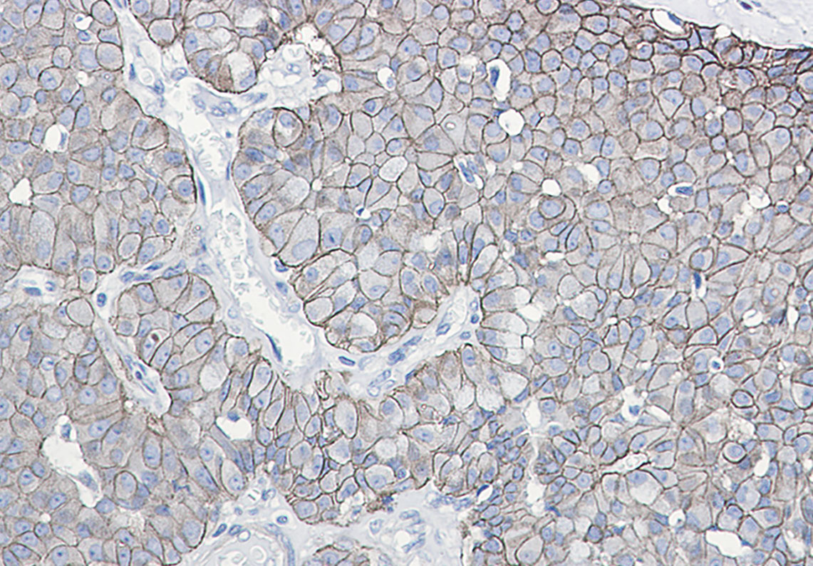 Phospho-E Cadherin (Ser838/Ser840) Rabbit mAb ABZ4559
