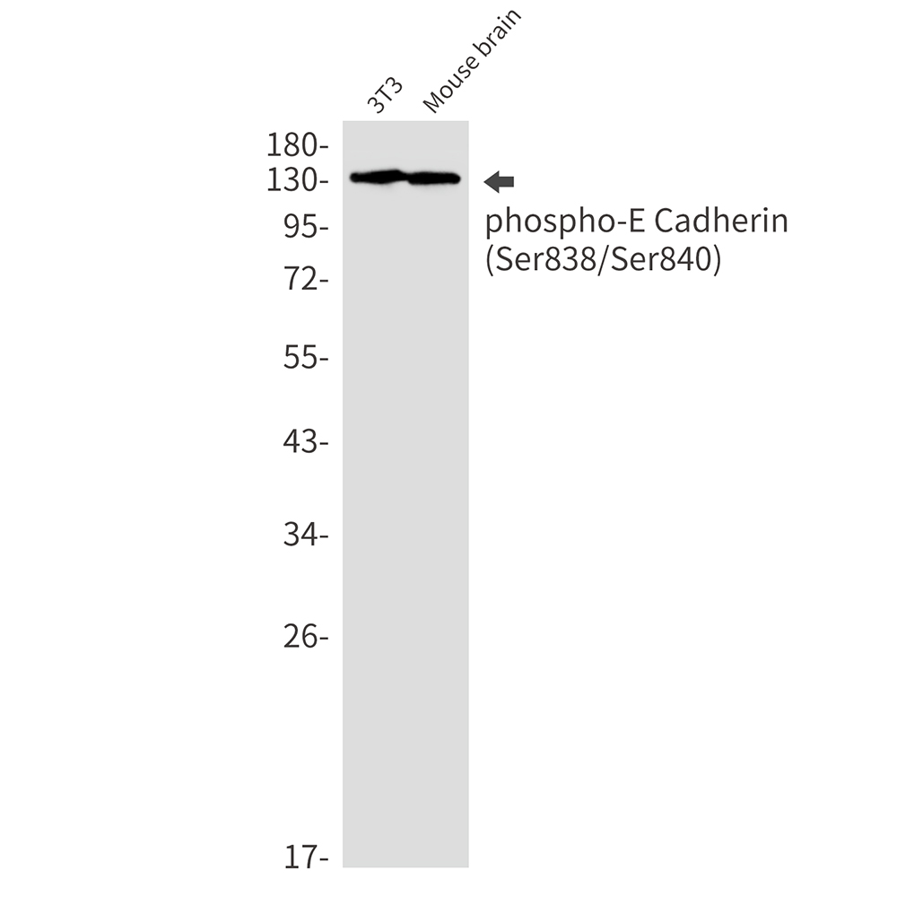 Phospho-E Cadherin (Ser838/Ser840) Rabbit mAb ABZ4559