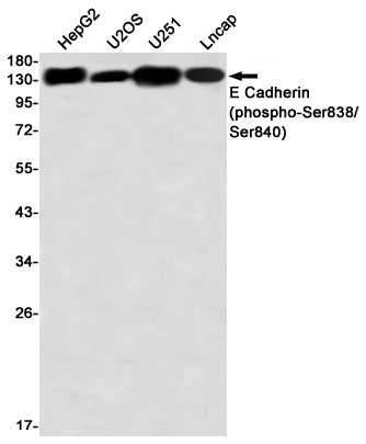 Phospho-E Cadherin (Ser838/Ser840) Rabbit mAb ABZ4559