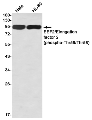 Phospho-EEF2/Elongation factor 2 (Thr56/Thr58) Rabbit mAb ABZ4560