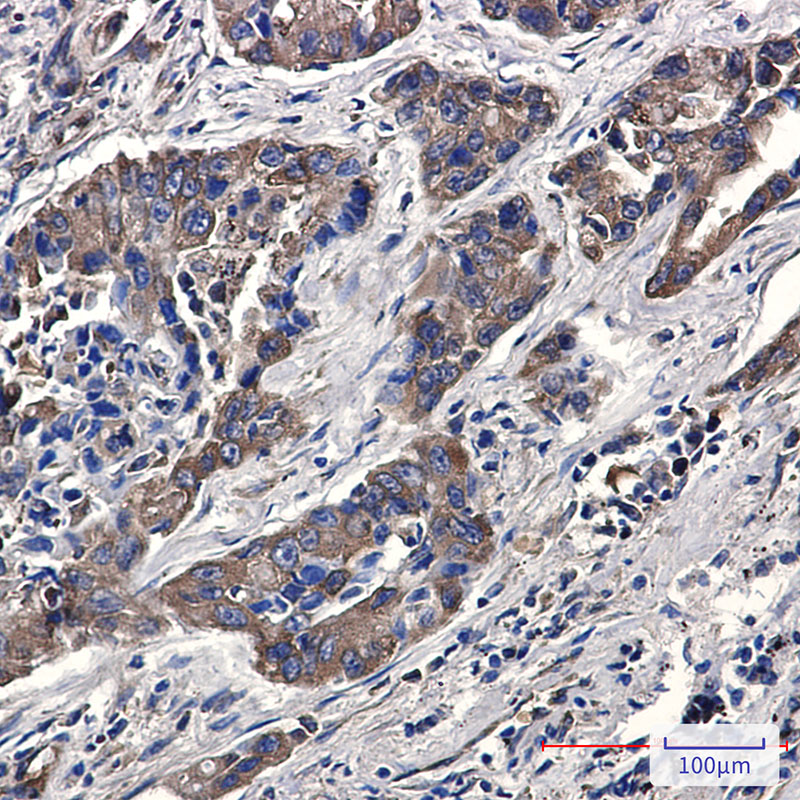 Phospho-eIF4B (Ser406) Rabbit mAb ABZ4561