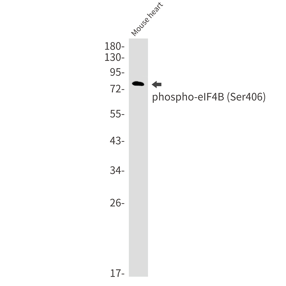 Phospho-eIF4B (Ser406) Rabbit mAb ABZ4561