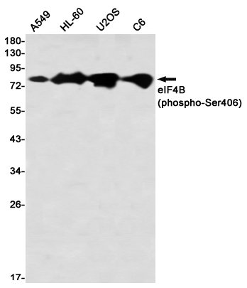 Phospho-eIF4B (Ser406) Rabbit mAb ABZ4561