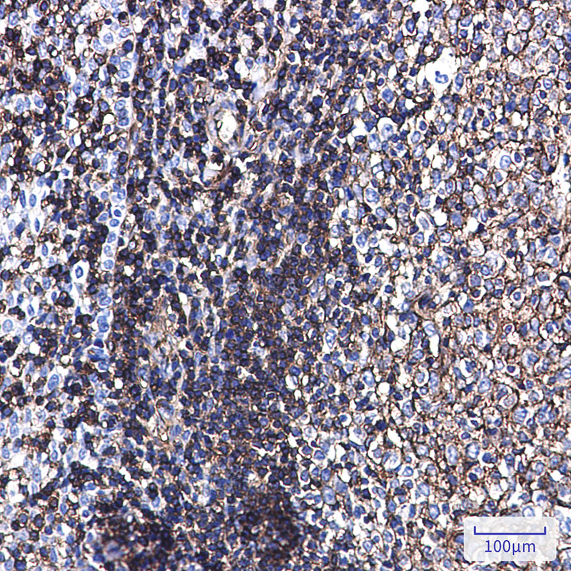 Phospho-Ezrin/Radixin/Moesin (Thr567/Thr564/Thr558) Rabbit mAb ABZ4562