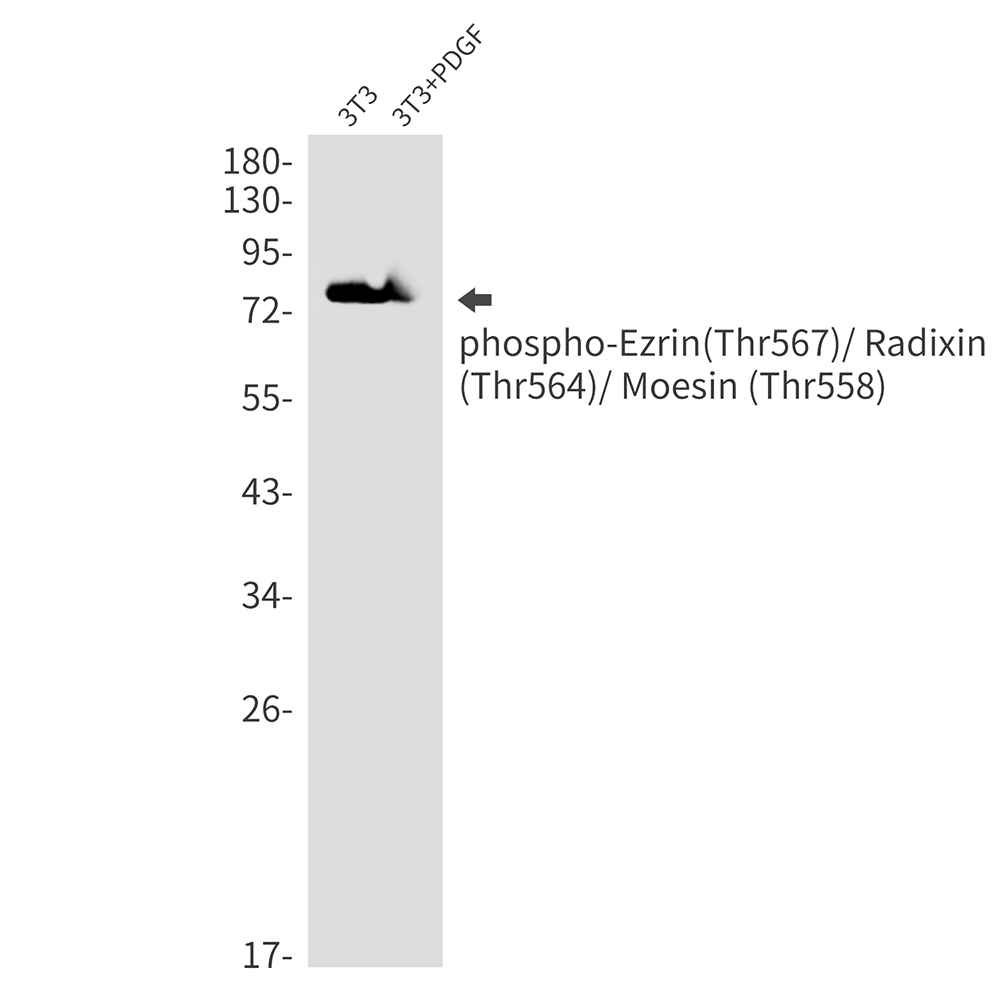 Phospho-Ezrin/Radixin/Moesin (Thr567/Thr564/Thr558) Rabbit mAb ABZ4562