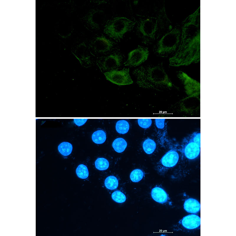 Phospho-Filamin A/B (Ser2152/Ser2107) Rabbit mAb ABZ4563