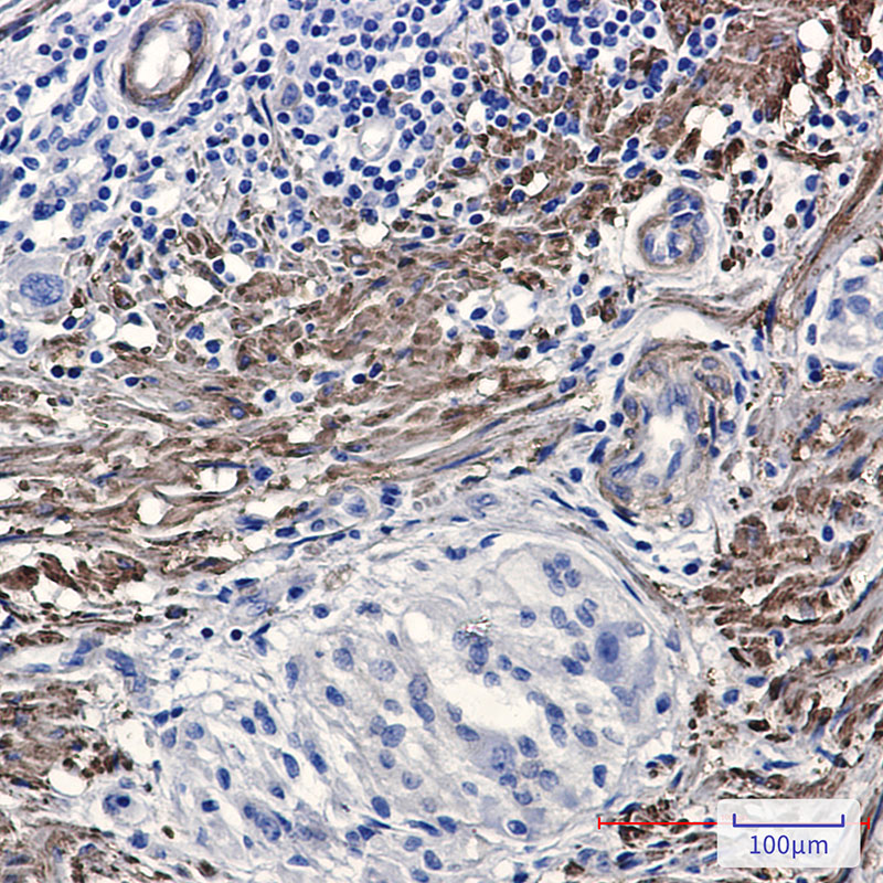 Phospho-Filamin A/B (Ser2152/Ser2107) Rabbit mAb ABZ4563