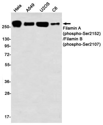 Phospho-Filamin A/B (Ser2152/Ser2107) Rabbit mAb ABZ4563
