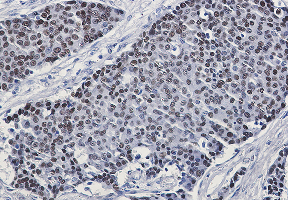 Phospho-GATA3 (Ser308) Rabbit mAb ABZ4564