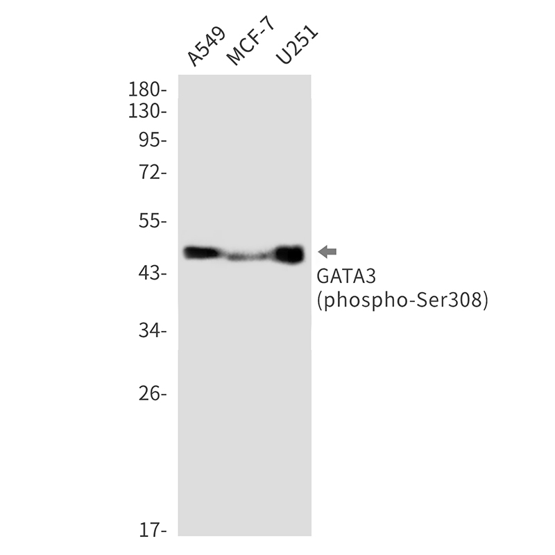 Phospho-GATA3 (Ser308) Rabbit mAb ABZ4564