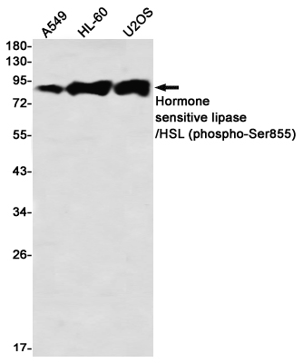 Phospho-Hormone Sensitive Lipase/HSL (Ser855) Rabbit mAb ABZ4565