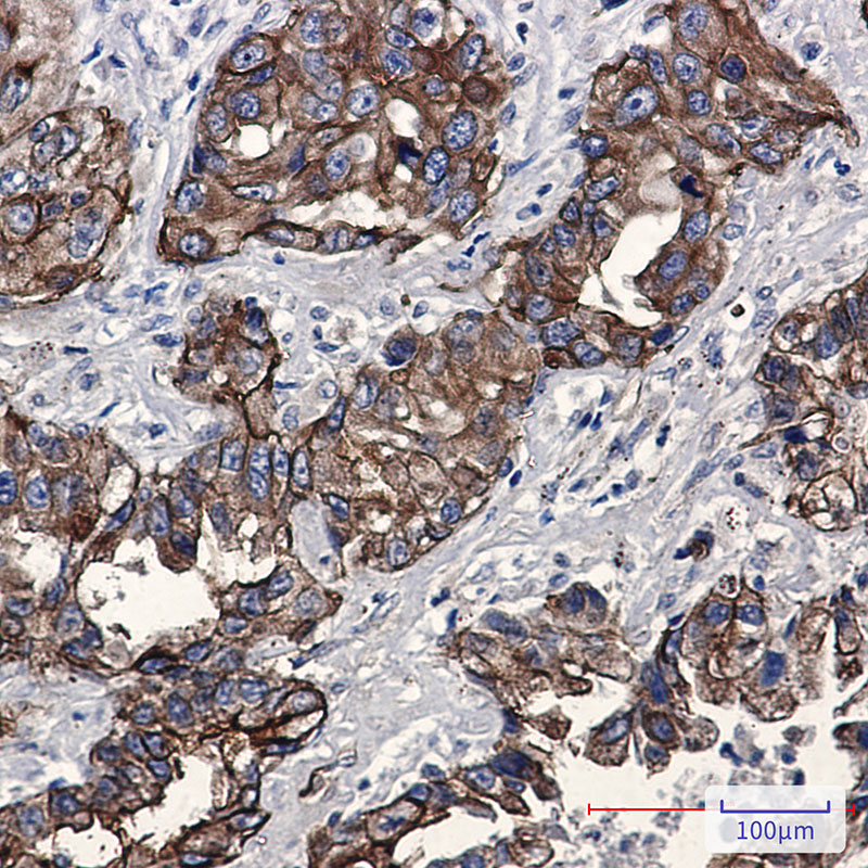Phospho-Moesin (Thr558) Rabbit mAb ABZ4568