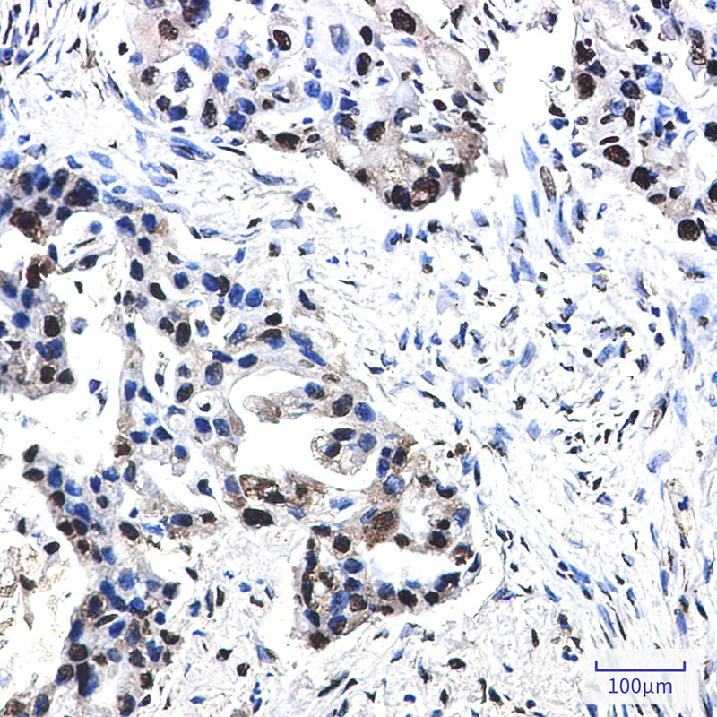 Phospho-Nucleophosmin (Thr199) Rabbit mAb ABZ4569